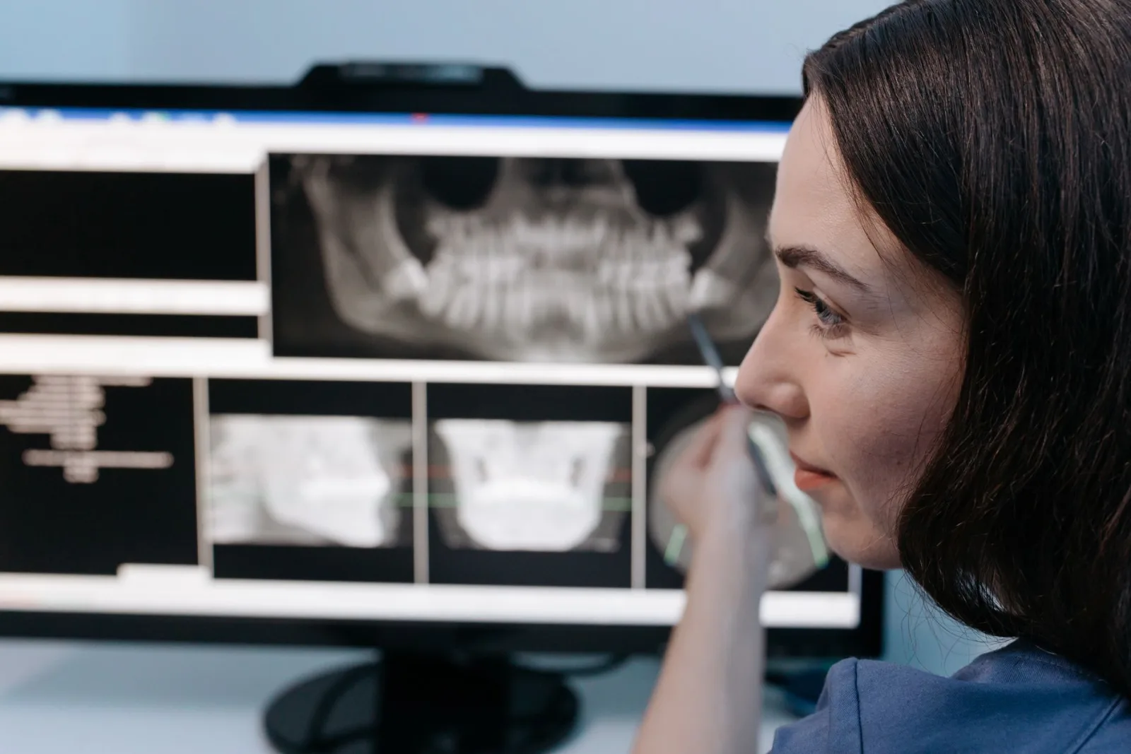 Female dentist reviewing digital dental x-rays on a computer screen in a clinic setting.